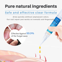 Nail Repair Essence Pen