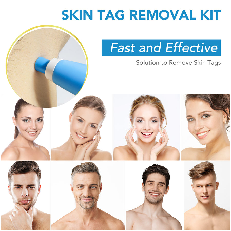 Auto Skin Removal Kit Skin Removal Pen Painless Fast-acting Blemish-free Skin